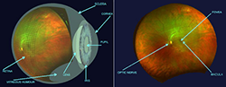 Optos Eye Anatomy